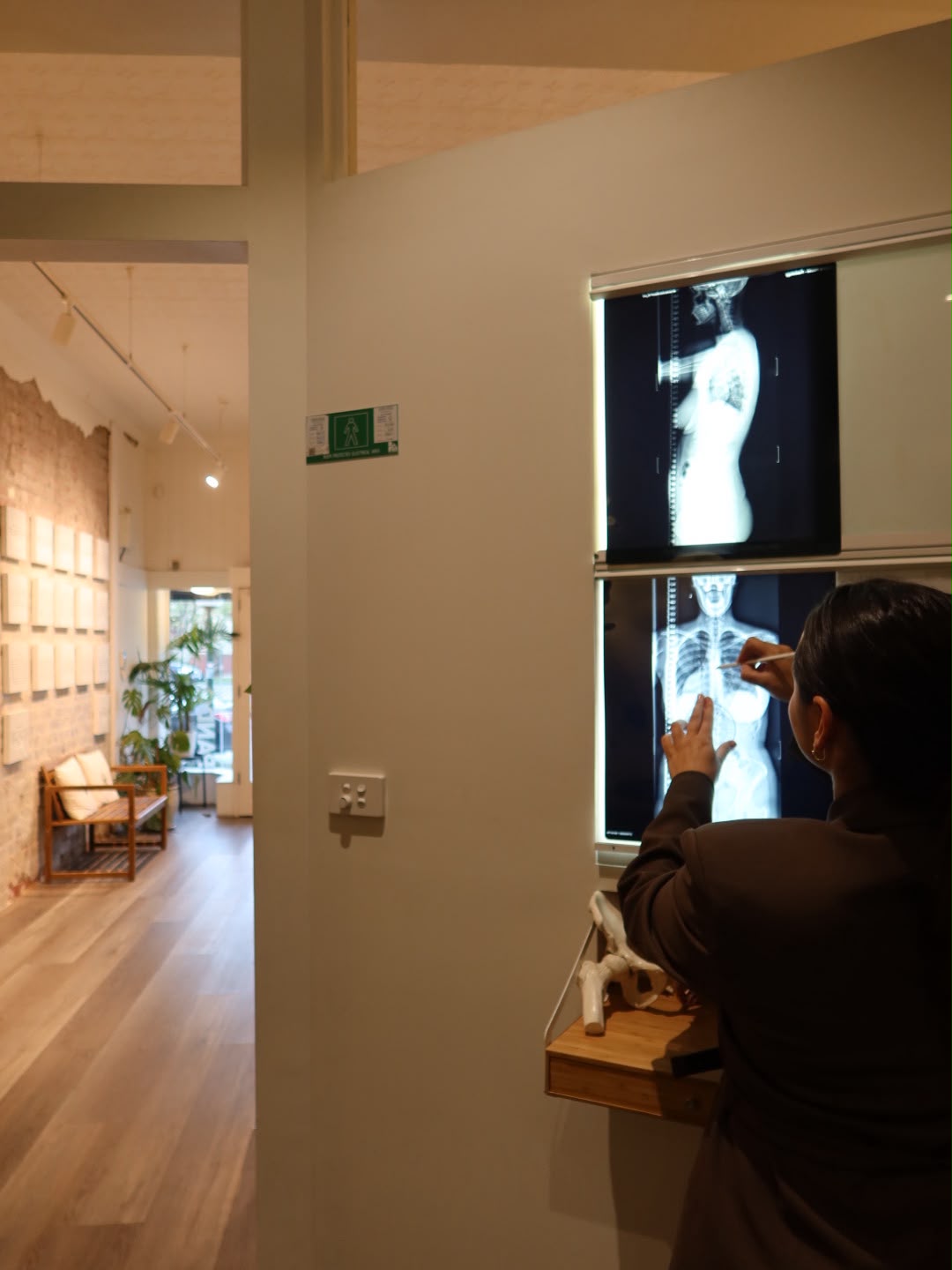 Chiropractor reviewing a spinal X-ray